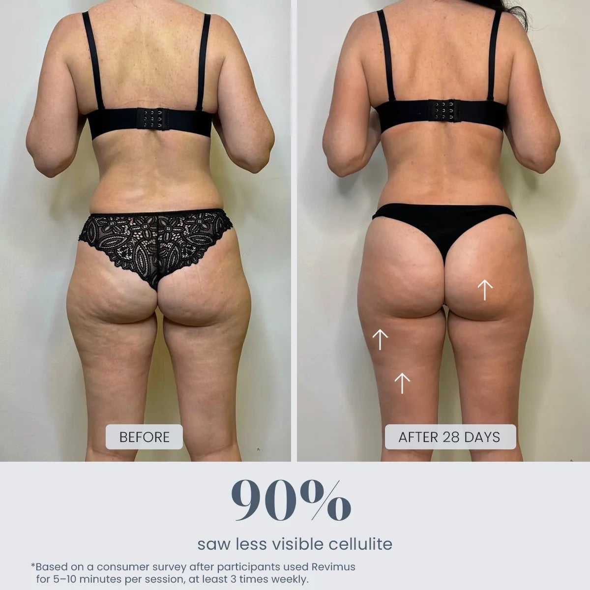 Anti-Cellulite Massager